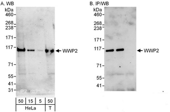 Rabbit anti-WWP2 Antibody, Affinity Purified