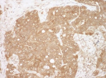 Rabbit anti-CacyBP Antibody, Affinity Purified