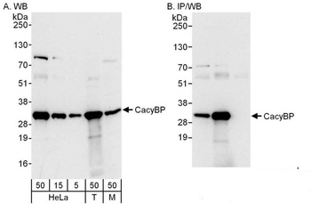 Rabbit anti-CacyBP Antibody, Affinity Purified