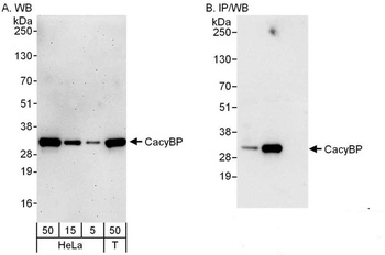 Rabbit anti-CacyBP Antibody, Affinity Purified