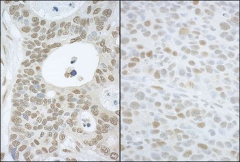 Rabbit anti-CAND1 Antibody, Affinity Purified