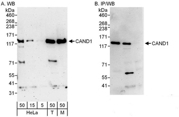 Rabbit anti-CAND1 Antibody, Affinity Purified