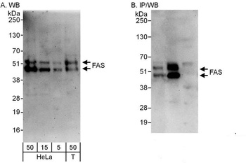 Rabbit anti-FAS Antibody, Affinity Purified