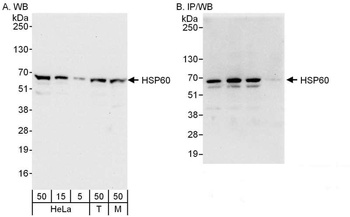 Rabbit anti-HSP60 Antibody, Affinity Purified