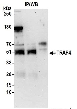 Rabbit anti-TRAF4 Antibody, Affinity Purified