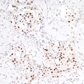 Rabbit anti-TRAF4 Antibody, Affinity Purified