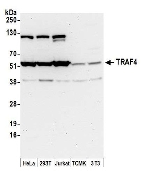 Rabbit anti-TRAF4 Antibody, Affinity Purified