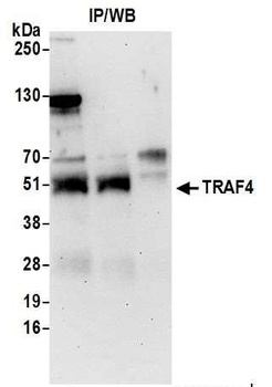 Rabbit anti-TRAF4 Antibody, Affinity Purified