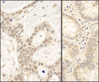 Rabbit anti-FAF1 Antibody, Affinity Purified