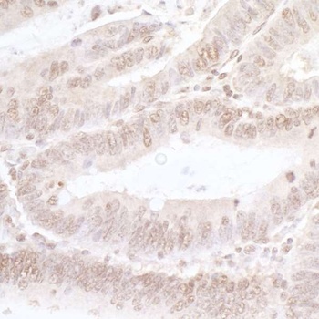 Rabbit anti-NFAT3 Antibody, Affinity Purified