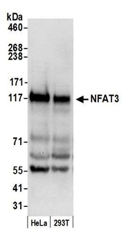Rabbit anti-NFAT3 Antibody, Affinity Purified
