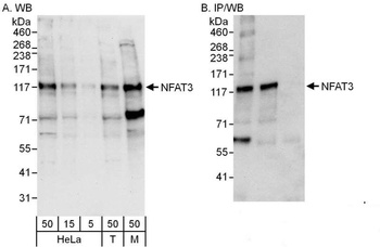 Rabbit anti-NFAT3 Antibody, Affinity Purified