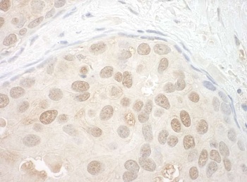 Rabbit anti-ORC2 Antibody, Affinity Purified
