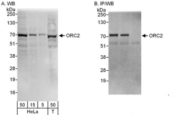 Rabbit anti-ORC2 Antibody, Affinity Purified