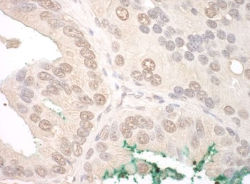 Rabbit anti-ORC2 Antibody, Affinity Purified