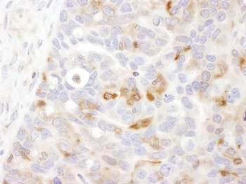 Rabbit anti-Bin1 Antibody, Affinity Purified
