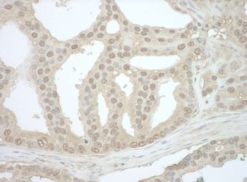 Rabbit anti-Bin1 Antibody, Affinity Purified