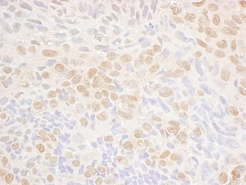 Rabbit anti-DRAK1 Antibody, Affinity Purified