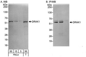 Rabbit anti-DRAK1 Antibody, Affinity Purified