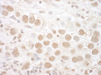 Rabbit anti-CTNNBL1 Antibody, Affinity Purified