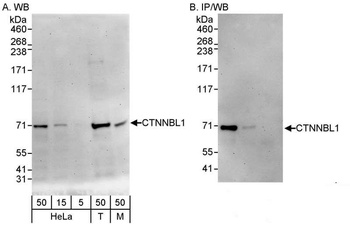 Rabbit anti-CTNNBL1 Antibody, Affinity Purified