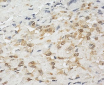Rabbit anti-LPP Antibody, Affinity Purified