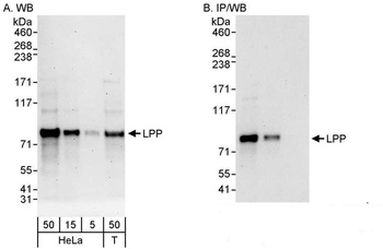 Rabbit anti-LPP Antibody, Affinity Purified