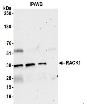 Rabbit anti-RACK1 Antibody, Affinity Purified