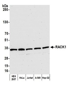 Rabbit anti-RACK1 Antibody, Affinity Purified