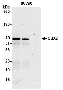 Rabbit anti-CBX2 Antibody, Affinity Purified