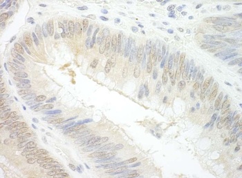 Rabbit anti-EAF2 Antibody, Affinity Purified