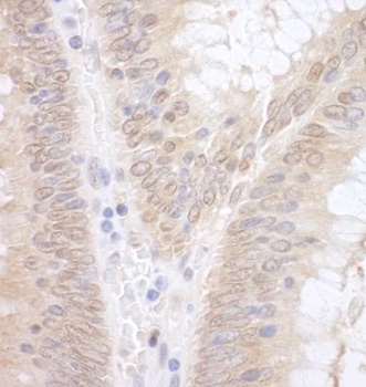 Rabbit anti-EAF2 Antibody, Affinity Purified