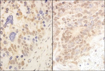 Rabbit anti-Cul2 Antibody, Affinity Purified
