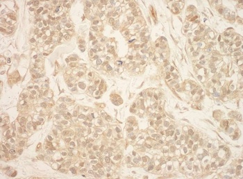 Rabbit anti-RSK2 Antibody, Affinity Purified
