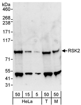 Rabbit anti-RSK2 Antibody, Affinity Purified