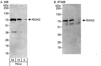 Rabbit anti-RIOK2 Antibody, Affinity Purified