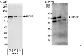 Rabbit anti-RIOK2 Antibody, Affinity Purified