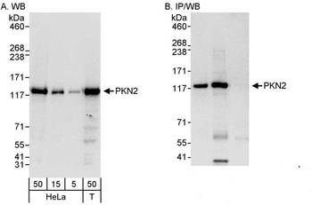 Rabbit anti-PKN2 Antibody, Affinity Purified