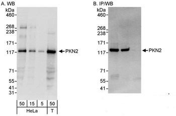 Rabbit anti-PKN2 Antibody, Affinity Purified