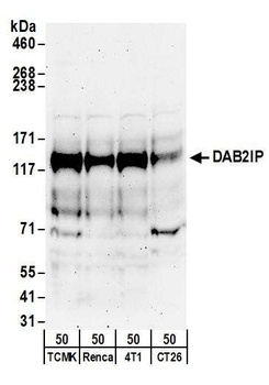 Rabbit anti-DAB2IP Antibody, Affinity Purified