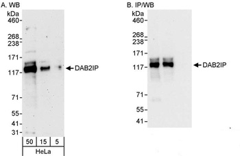 Rabbit anti-DAB2IP Antibody, Affinity Purified