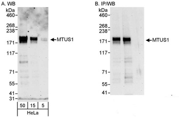 Rabbit anti-MTUS1 Antibody, Affinity Purified