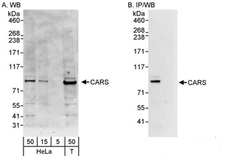 Rabbit anti-CARS Antibody, Affinity Purified