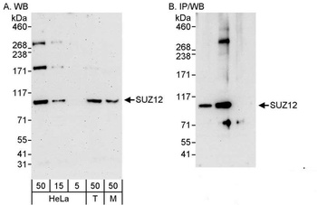 Rabbit anti-SUZ12 Antibody, Affinity Purified