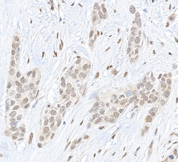 Rabbit anti-Pc2 Antibody, Affinity Purified