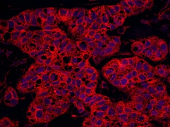 Rabbit anti-Septin 9 Antibody, Affinity Purified