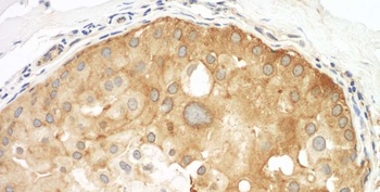 Rabbit anti-Septin 9 Antibody, Affinity Purified