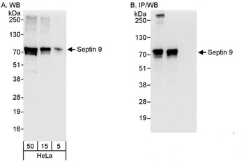 Rabbit anti-Septin 9 Antibody, Affinity Purified