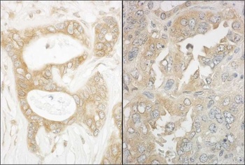 Rabbit anti-EB1 Antibody, Affinity Purified