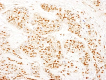 Rabbit anti-RAD23B Antibody, Affinity Purified
